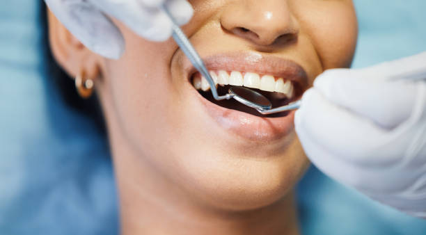 Best Emergency Denture Repair in Union, NJ
